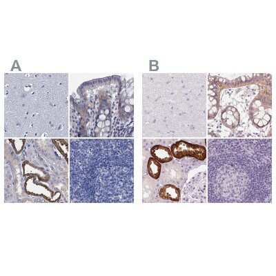 Immunohistochemistry-Paraffin: TMEM72 Antibody [NBP1-90808]
