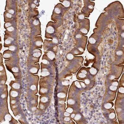 Immunohistochemistry-Paraffin: TMEM74B Antibody [NBP1-94038]