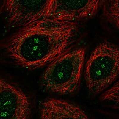 Immunocytochemistry/ Immunofluorescence: TMEM79 Antibody [NBP2-47601]