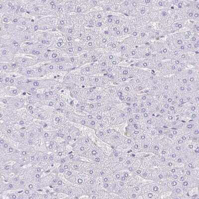 Immunohistochemistry-Paraffin: TMEM79 Antibody [NBP2-47601]