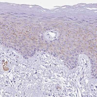 Immunohistochemistry-Paraffin: TMEM79 Antibody [NBP2-47601]