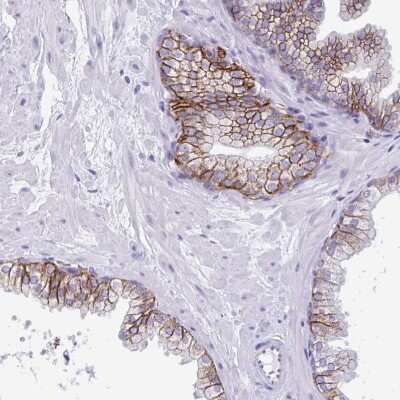 Immunohistochemistry-Paraffin: TMEM79 Antibody [NBP2-47601]