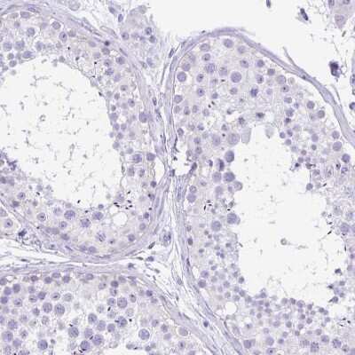 Immunohistochemistry-Paraffin: TMEM79 Antibody [NBP2-47601]