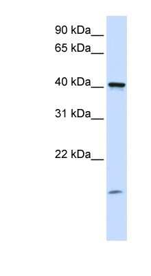 Western Blot: TMEM79 Antibody [NBP1-59832]