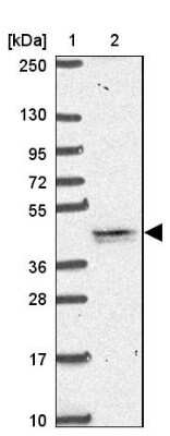 Western Blot: TMEM79 Antibody [NBP2-47601]