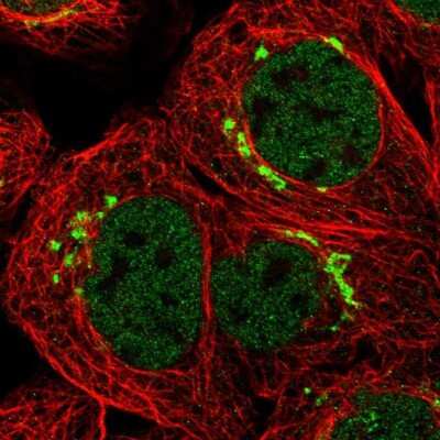 Immunocytochemistry/ Immunofluorescence: TMEM87A Antibody [NBP1-90531]