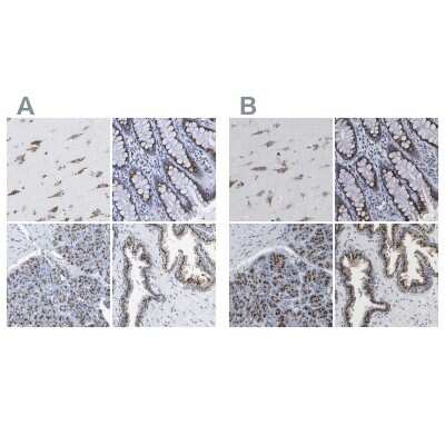 Immunohistochemistry-Paraffin: TMEM87A Antibody [NBP1-90531]