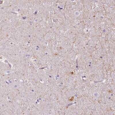 Immunohistochemistry-Paraffin: TMEM88B Antibody [NBP2-38078]