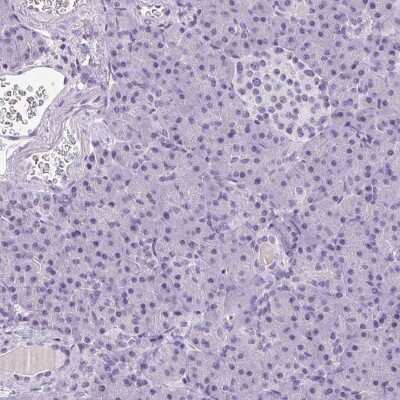 Immunohistochemistry-Paraffin: TMEM88B Antibody [NBP2-38078]