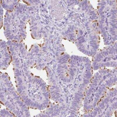 Immunohistochemistry: TMEM89 Antibody [NBP2-30826]