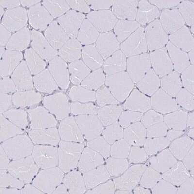 Immunohistochemistry-Paraffin: TMEM8C Antibody [NBP2-34175]
