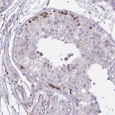 Immunohistochemistry-Paraffin: TMEM8C Antibody [NBP2-34175]