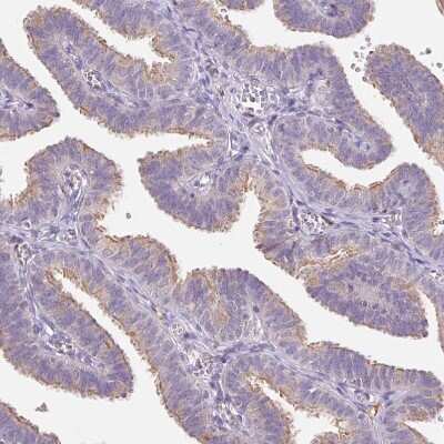 Immunohistochemistry-Paraffin: TMEM93 Antibody [NBP2-38000]