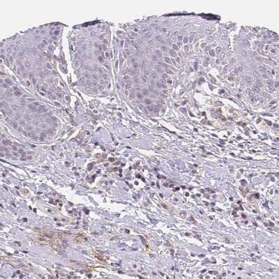 Immunohistochemistry-Paraffin: TMEM93 Antibody [NBP2-38000]