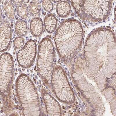 Immunohistochemistry-Paraffin: TMEM93 Antibody [NBP2-38000]