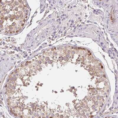 Immunohistochemistry-Paraffin: TMEM93 Antibody [NBP2-38000]