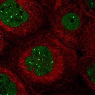 Immunocytochemistry/ Immunofluorescence: TMEM94 Antibody [NBP1-86932]