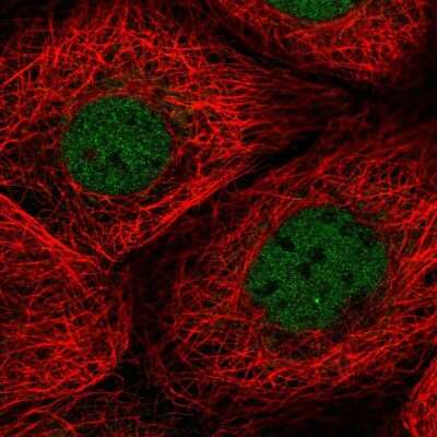 Immunocytochemistry/ Immunofluorescence: TMEM94 Antibody [NBP2-58077]