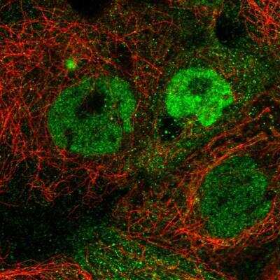 Immunocytochemistry/ Immunofluorescence: TMEM98 Antibody [NBP1-84154]