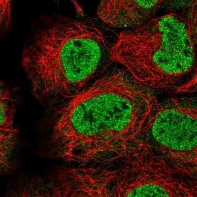 Immunocytochemistry/ Immunofluorescence: TMEM98 Antibody [NBP2-54914]