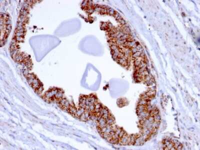 Immunohistochemistry-Paraffin: TMEPAI Antibody (PMEPA1/2696) [NBP2-79756]