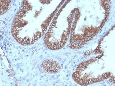 Immunohistochemistry-Paraffin: TMEPAI Antibody (PMEPA1/6421R) - Azide and BSA Free [NBP3-08260]