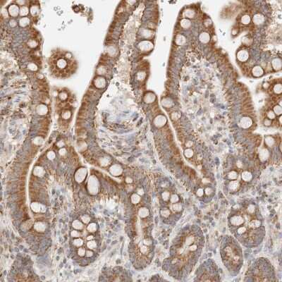 Immunohistochemistry-Paraffin: TMPPE Antibody [NBP1-93749]