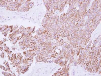Immunohistochemistry-Paraffin: TMPRSS11B Antibody [NBP2-20667]