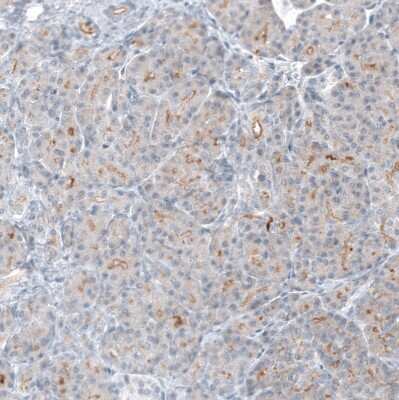 Immunohistochemistry-Paraffin: TMPRSS2 Antibody (CL12512) [NBP3-18573]