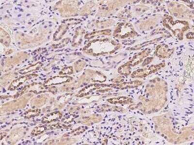 Immunohistochemistry-Paraffin: TMPRSS2 Antibody [NBP2-97969]