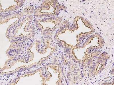 Immunohistochemistry-Paraffin: TMPRSS2 Antibody [NBP2-97969]