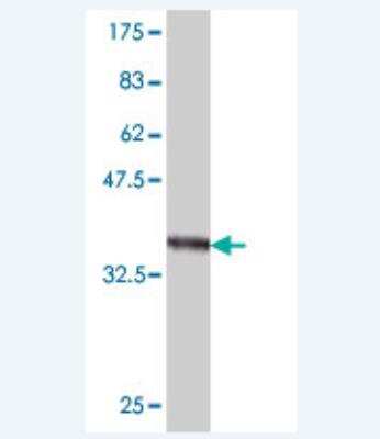 Western Blot: TMPRSS3 Antibody (2E1) [H00064699-M01]