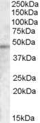 Western Blot: TMPRSS3 Antibody [NB100-77342]