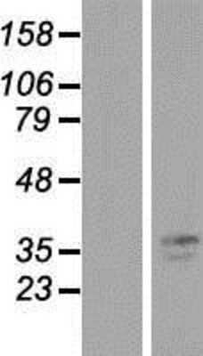 Western Blot: TMPRSS3 Overexpression Lysate [NBP2-09933]