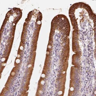 Immunohistochemistry: TMSB15B Antibody [NBP2-38054]