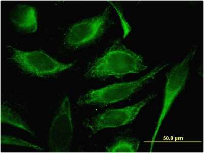 Immunocytochemistry/ Immunofluorescence: TMSB4Y Antibody (6G4) [H00009087-M05]