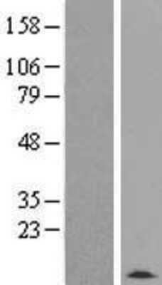 Western Blot: TMSB4Y Overexpression Lysate [NBP2-07898]
