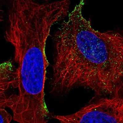 Immunocytochemistry/ Immunofluorescence: TMTC4 Antibody [NBP1-83685]
