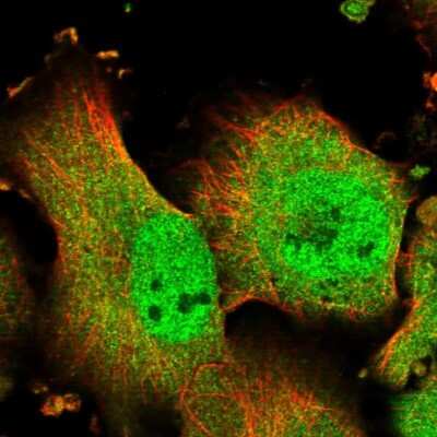 Immunocytochemistry/ Immunofluorescence: TMUB1 Antibody [NBP1-86731]
