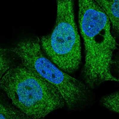 Immunocytochemistry/ Immunofluorescence: TMX2 Antibody [NBP2-49405]