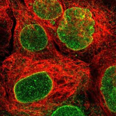 Immunocytochemistry/ Immunofluorescence: TMX4 Antibody [NBP1-85158]