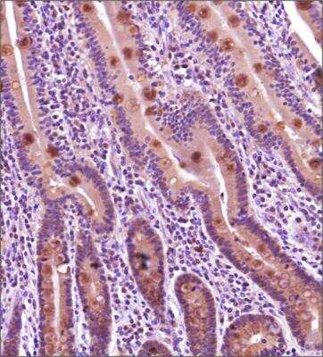 Immunohistochemistry-Paraffin: TNF RI/TNFRSF1A Antibody - BSA Free [NBP2-78785]