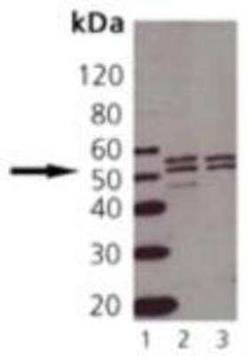 Western Blot: TNF RI/TNFRSF1A Antibody [NBP1-97453]