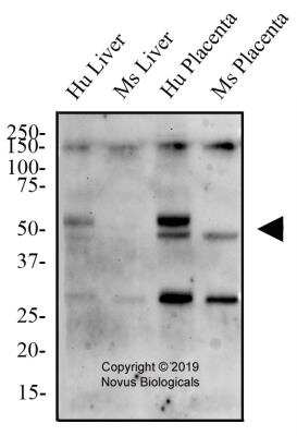 Western Blot: TNF RI/TNFRSF1A AntibodyBSA Free [NBP2-78785]