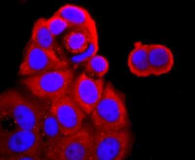 Immunocytochemistry/ Immunofluorescence: TNF RII/TNFRSF1B Antibody (JM113-01) [NBP2-67218]