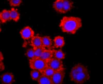 Immunocytochemistry/ Immunofluorescence: TNF RII/TNFRSF1B Antibody (JM113-01) [NBP2-67218]