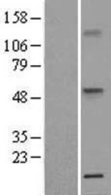 Western Blot: TNF RI/TNFRSF1A Overexpression Lysate [NBL1-17154]