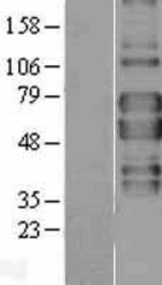 Western Blot: TNF RII/TNFRSF1B Overexpression Lysate [NBL1-17155]