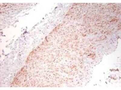 Immunohistochemistry: TNF-alpha Antibody - Azide Free [NB600-587]