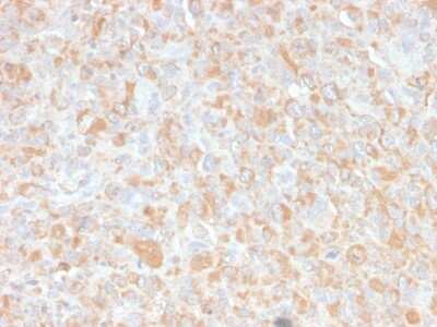 Immunohistochemistry-Paraffin: TNF-alpha Antibody (4C6-H8) - Azide and BSA Free [NBP2-34539]